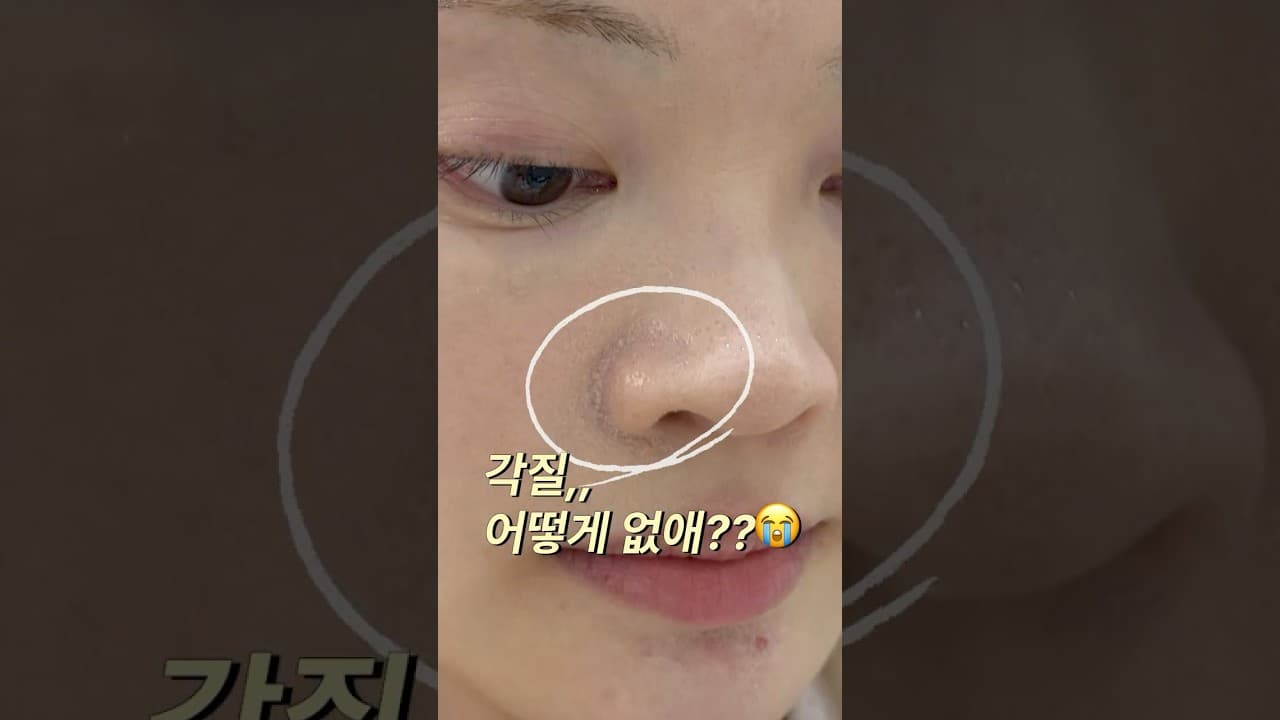 여드름 흉터 케어 루틴
